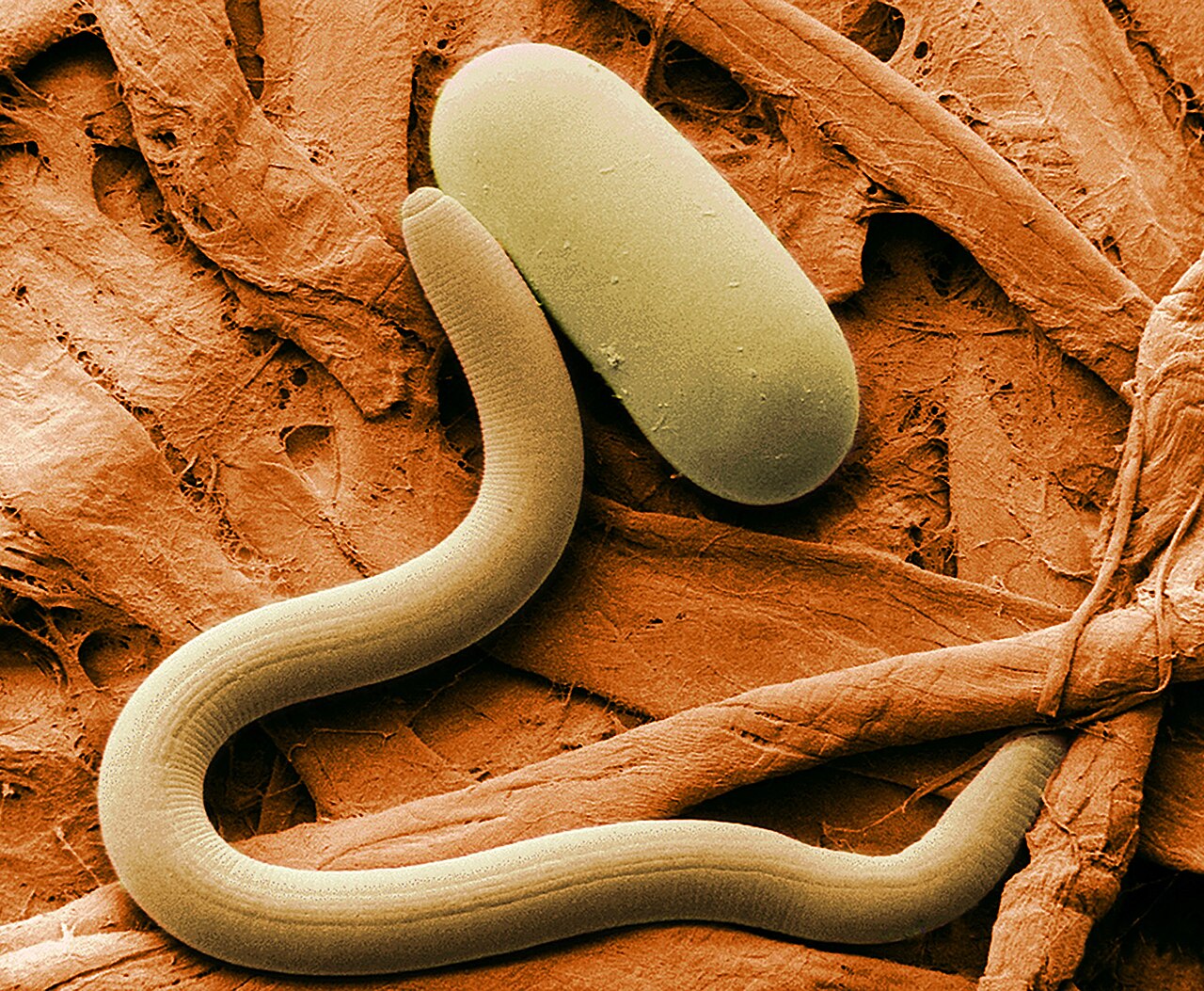 nematode delle cisti della soia — Heterodera glycines