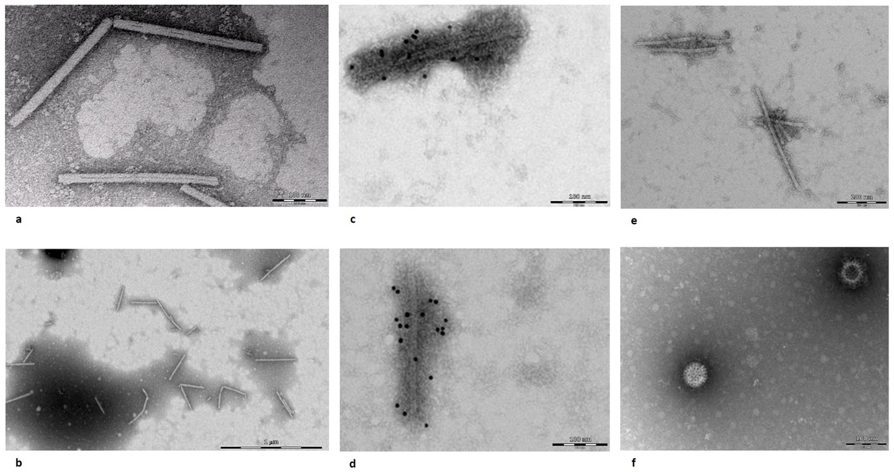 Paprika-Mildmosaikvirus — Pepper mild mottle virus