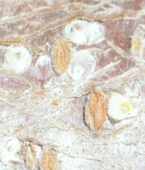 cocciniglia bianca del gelso — Pseudaulacaspis pentagona