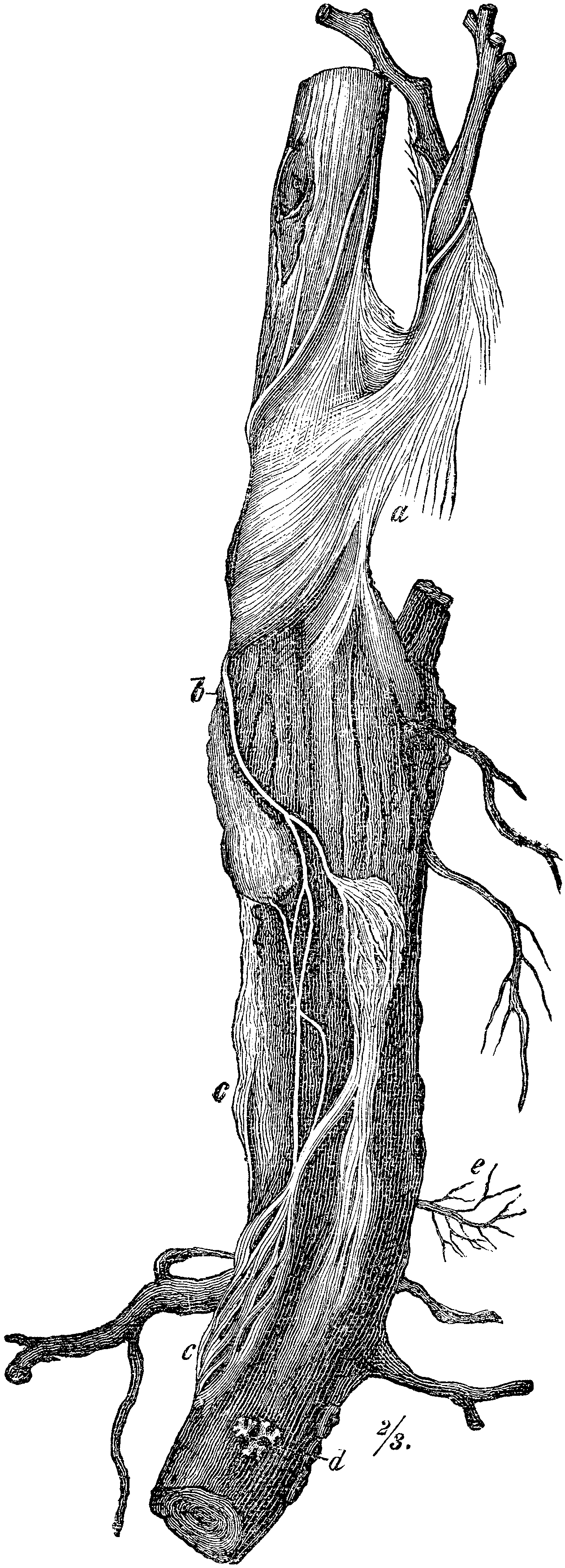 λευκή σήψη ριζών — Rosellinia necatrix