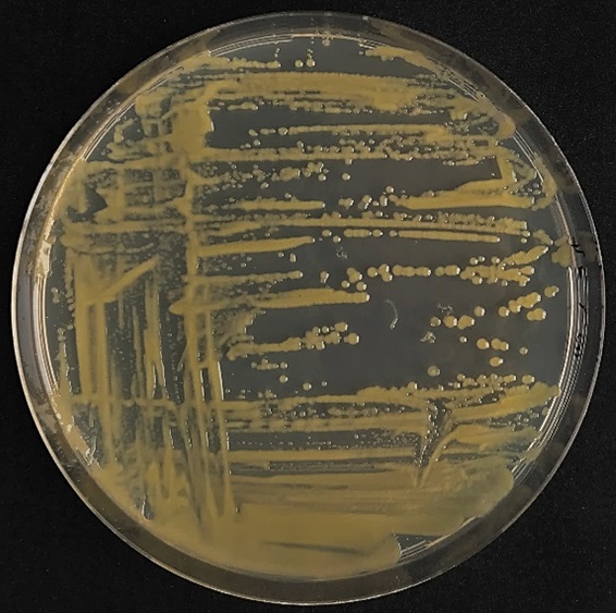 nervation noire du chou — Xanthomonas campestris pv. campestris